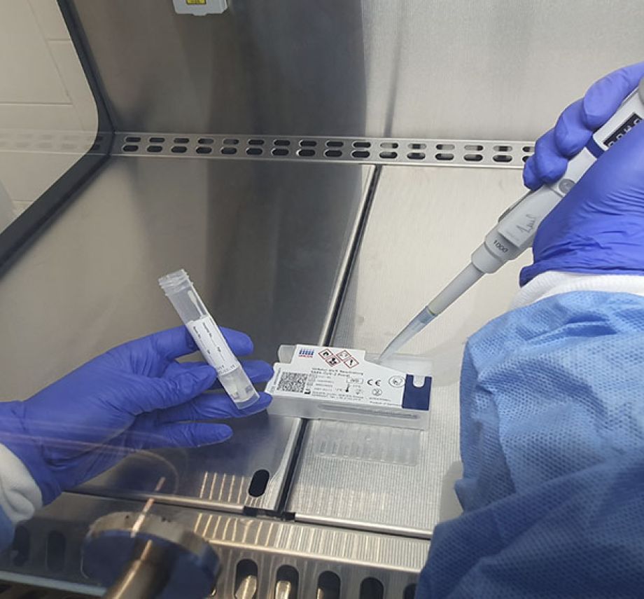 La Unidad de diagnóstico de covid-19 del Grupo Policlínica ya utiliza la PCR de saliva, recién salida al mercado.
